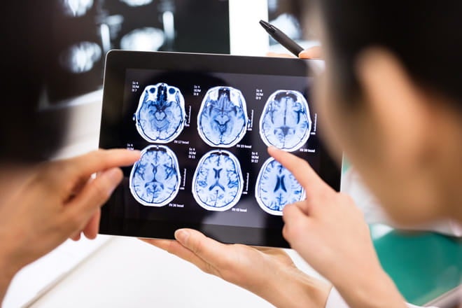 Advanced stroke care in Waco