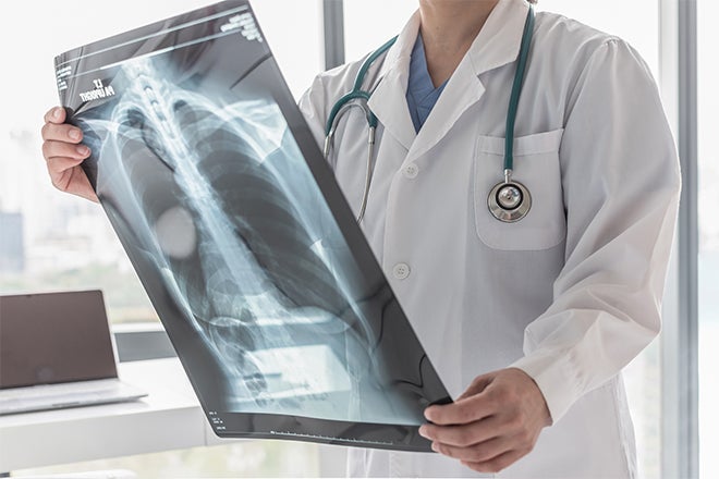 Ascension Seton Heart Specialty Care and Transplant Center in Austin, Texas, has pulmonary hypertension specialists.