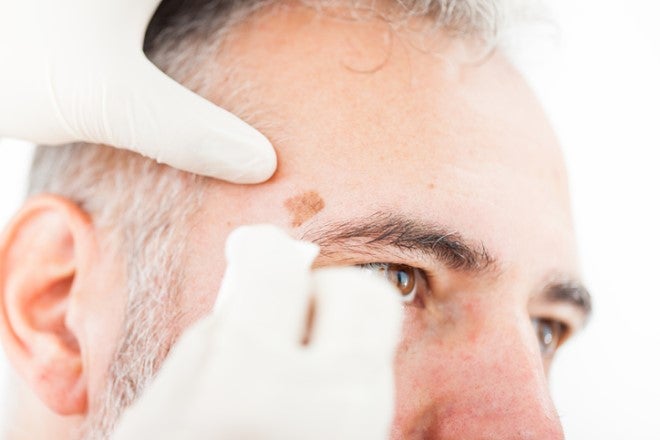 Doctor at Ascension of care examining a patient's face for skin cancer.